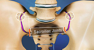 sacroiliac joint